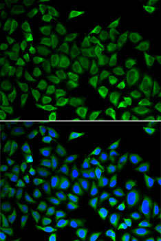 Immunofluorescence analysis of A-549 cells using CDC45 Polyclonal Antibody