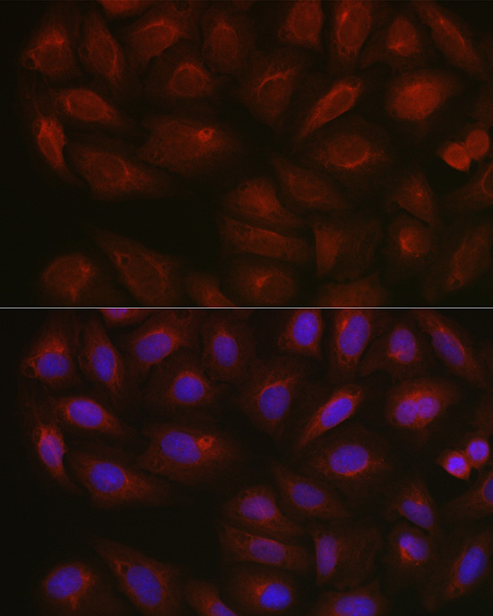 Immunofluorescence analysis of U2OS cells using [KO Validated] AMPKα2 Polyclonal Antibody at dilution of 1:100 (40x lens). Blue:DAPI for nuclear staining.