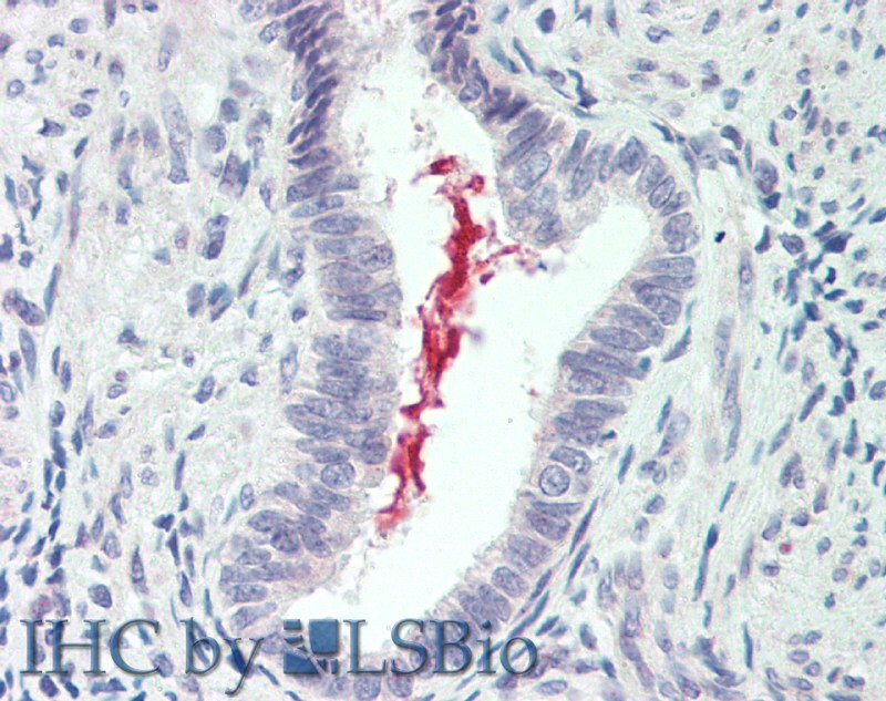 Immunohistochemistry of paraffin-embedded Lung tissue using IL19 Polyclonal Antibody at dilution of 1:90 (Elabscience Product Detected by Lifespan).