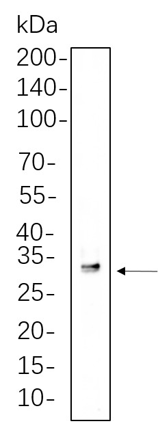Recombinant SDHB Monoclonal Antibody-searchlist-1