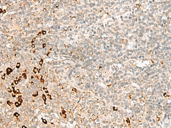 Immunohistochemistry of paraffin-embedded Human tonsil tissue  using RMND5A Polyclonal Antibody at dilution of 1:50(?200)