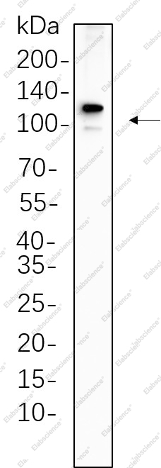Recombinant PMS2 Monoclonal Antibody - 1