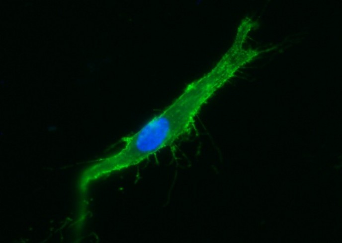 ICAM-1/CD54 Monoclonal Antibody - small - 2