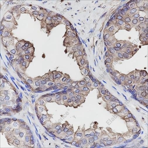 Recombinant Calpastatin Monoclonal Antibody - 1