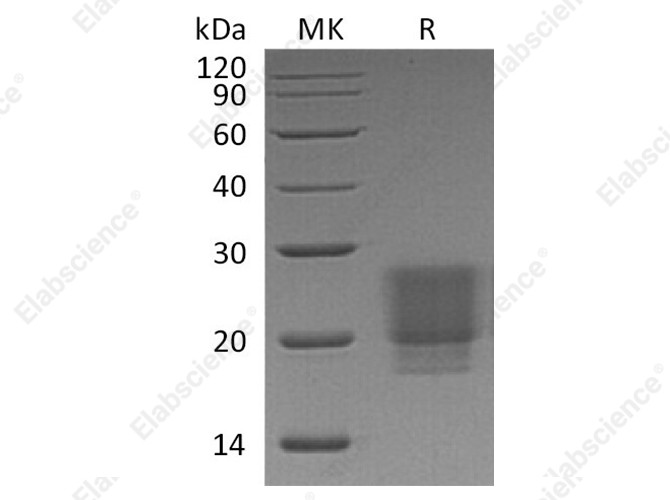 Recombinant Human/Mouse/Rat Irisin/FNDC5 Protein (His Tag) - 1