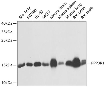 Western blot analysis of extracts of various cell lines using PPP3R1 Polyclonal Antibody at 1:1000 dilution.