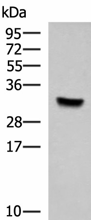 Western blot analysis of Hela cell lysate  using KCTD7 Polyclonal Antibody at dilution of 1:1000