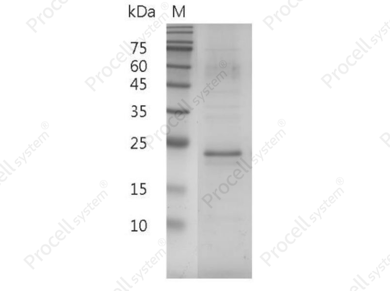 IL-17A/CTLA-8, Mouse, Recombinant - 1