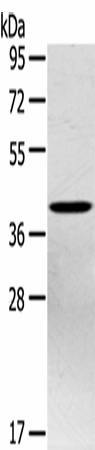 Western Blot analysis of Hepg2 cell using PTX3 Polyclonal Antibody at dilution of 1:400