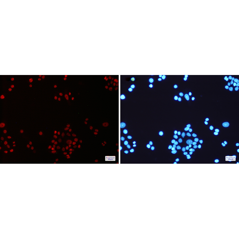 Immunofluorescence of MLH1(green) in Hela cells using MLH1 Rabbit mAb at dilution 1:200, and DAPI(blue)