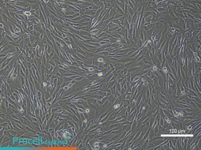 Rabbit Bladder Fibroblast Complete MediumRabbit Bladder Fibroblast Complete Medium - 1