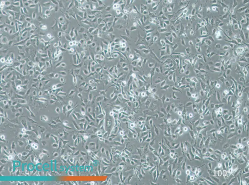 HBE135-E6E7 Cell Complete Medium - 3