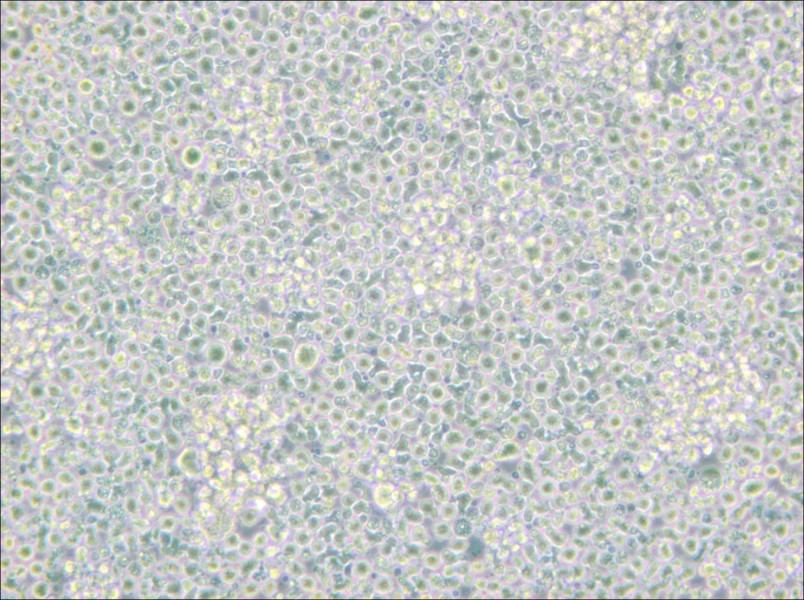 H9 [derivative of HuT 78] Cell Complete Medium - 5