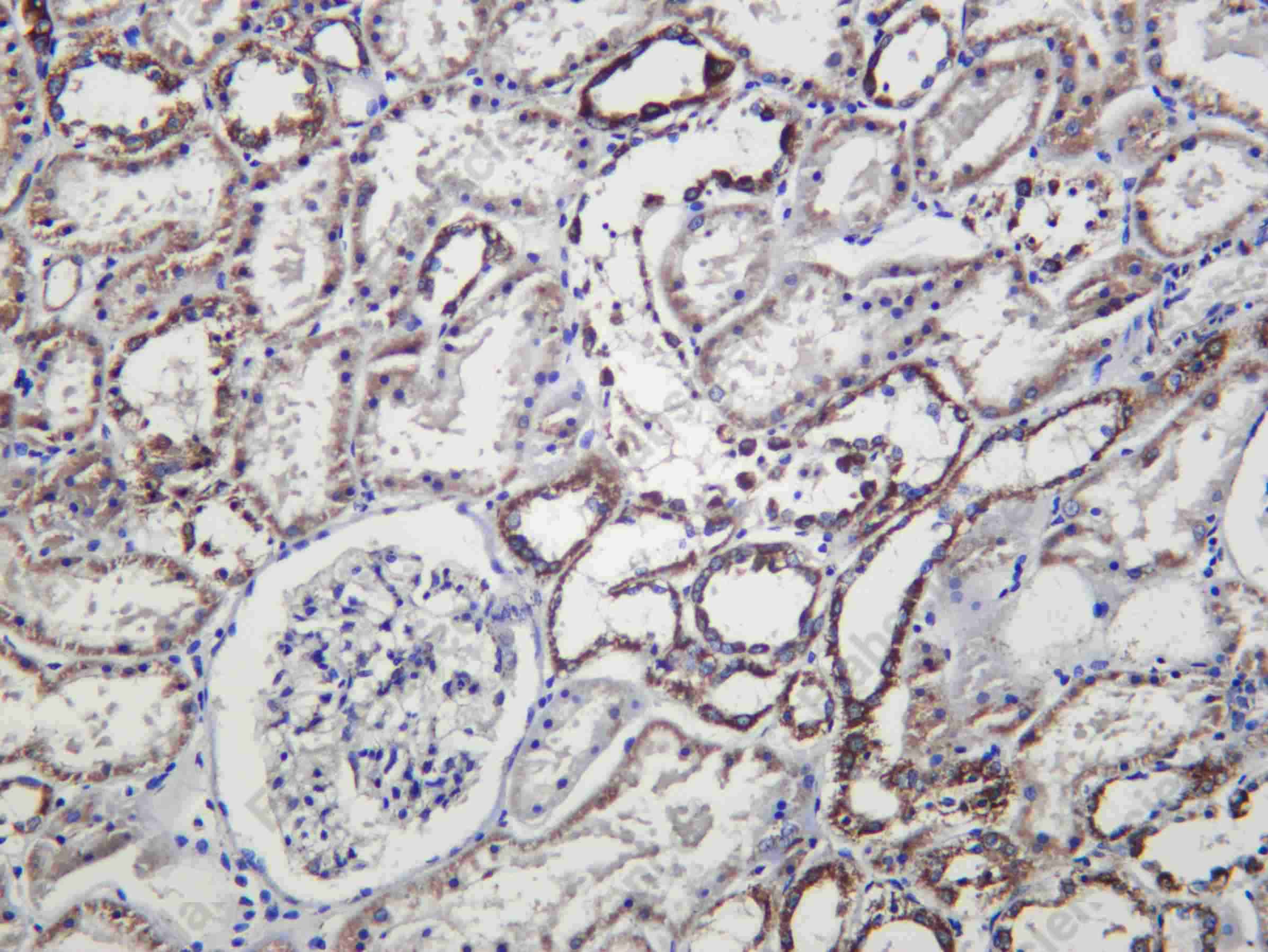 Recombinant FXN Monoclonal Antibody - 2