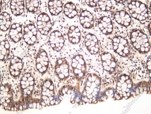 Recombinant 14-3-3 β Monoclonal Antibody - 1