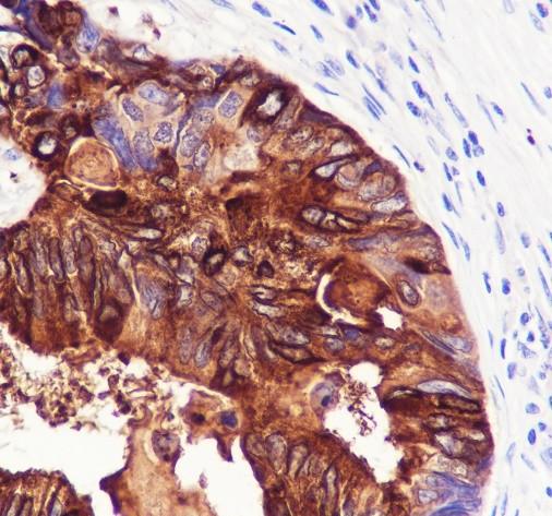 Recombinant TFF1/pS2 Monoclonal Antibody - 2