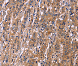 SEPT7 Polyclonal Antibody - 3