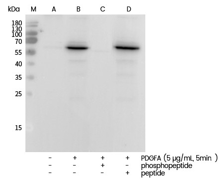 Recombinant Phospho-AKT (Ser473) Monoclonal Antibody - small - 6