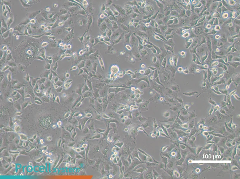 AnglneAnglne - 2