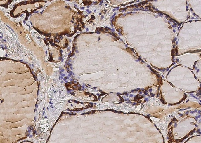 Thyroid peroxidase/TPO Monoclonal Antibody-searchlist-1