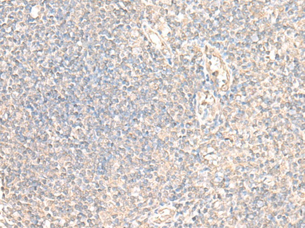 Immunohistochemistry of paraffin-embedded Human tonsil tissue  using PARS2 Polyclonal Antibody at dilution of 1:30(?200)