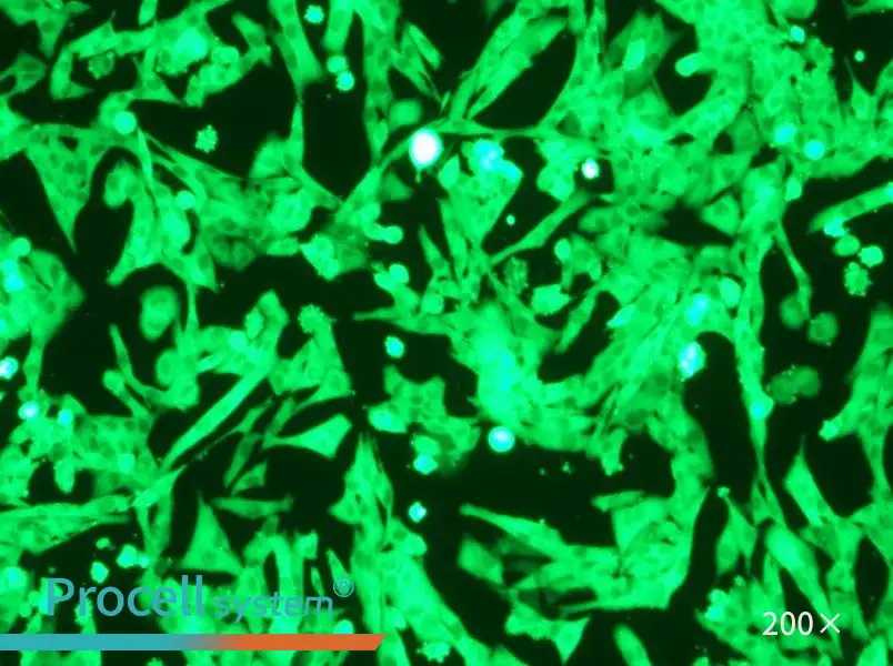 NCI-H446-GFP Cell Complete Medium - 4