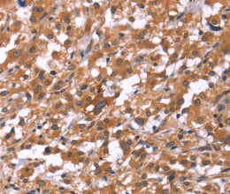 HSD17B1 Polyclonal Antibody - 2