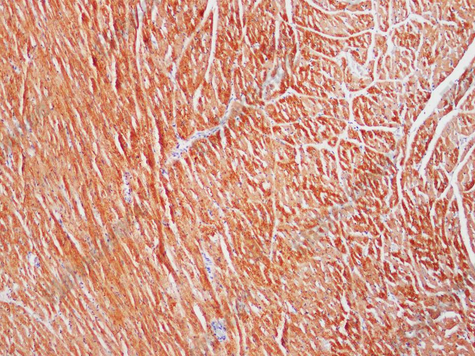 Recombinant Actinin-α2 Monoclonal Antibody - 2