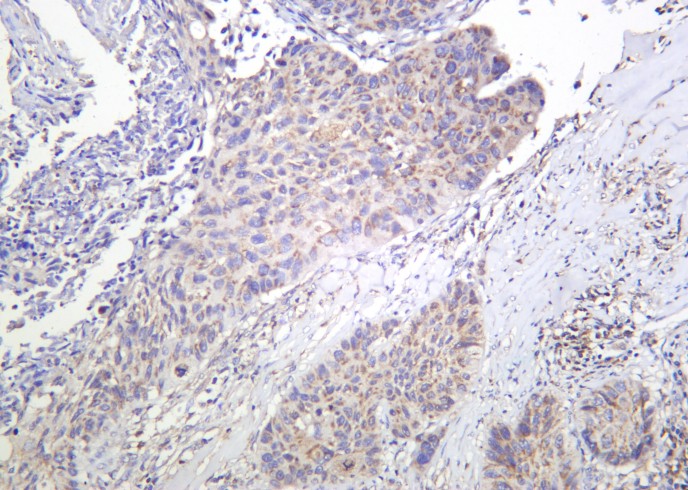 Recombinant Bim Monoclonal Antibody - small - 2