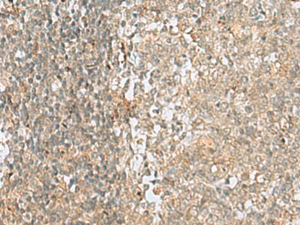 Immunohistochemistry of paraffin-embedded Human tonsil tissue  using HMG20A Polyclonal Antibody at dilution of 1:25(?200)