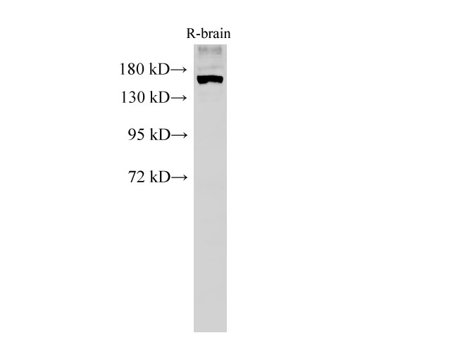 Western Blot analysis of Rat brain tissue using PARD3A Polyclonal Antibody at dilution of 1:500