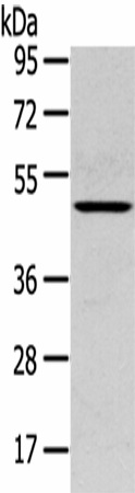 Western Blot analysis of Mouse lung tissue using SERPINB11 Polyclonal Antibody at dilution of 1/400