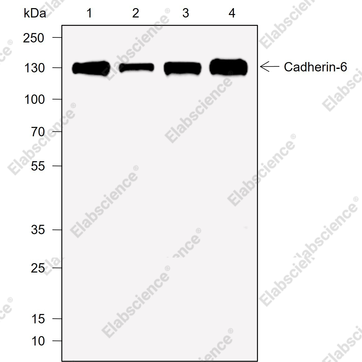 Recombinant Cadherin-6 Monoclonal Antibody - 1