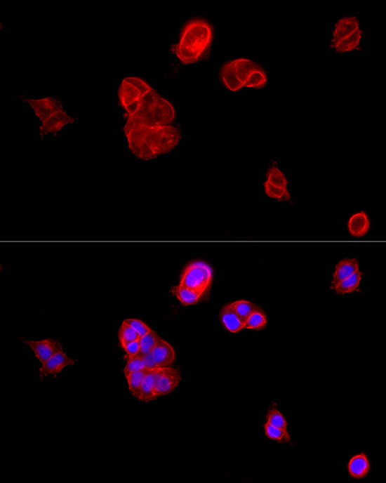 Immunofluorescence analysis of MCF7 cells using E-Cadherin Polyclonal Antibody at dilution of 1:100 (40x lens). Blue: DAPI for nuclear staining.