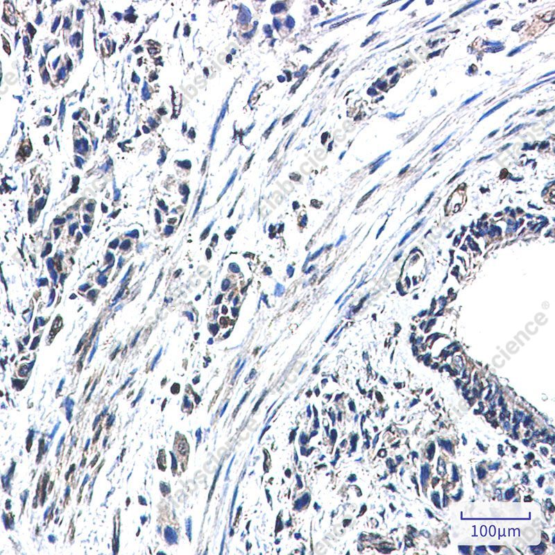 Recombinant GBP1 Monoclonal Antibody - 3