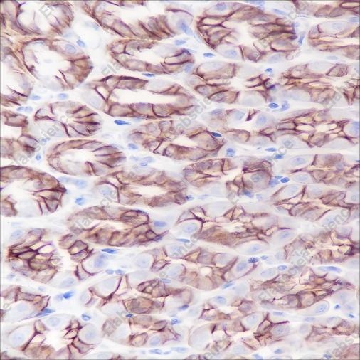 Recombinant PI3 Kinase p110 alpha Monoclonal Antibody - 6