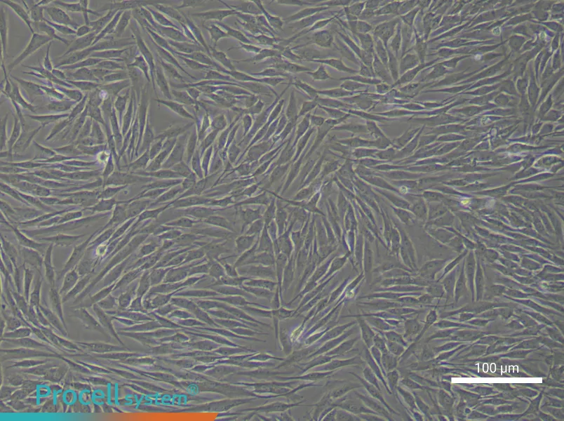 Human Mammary Cancer Fibroblast Complete Medium - 2