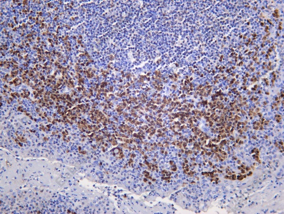 Recombinant IRF-4/MUM1 Monoclonal Antibody - 1