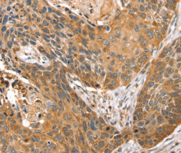 STX10 Polyclonal Antibody - 2