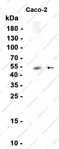 Recombinant TMPRSS2 Monoclonal Antibody - 1