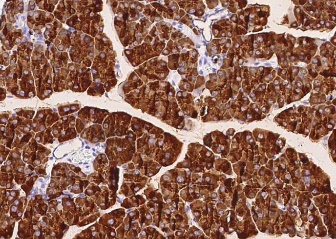 Recombinant Bile salt-activated lipase/CEL Monoclonal Antibody-searchlist-1