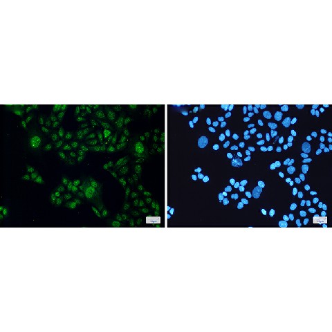 Immunofluorescence of STAT3(green) in Hela cells using STAT3 Rabbit mAb at dilution 1:200, and DAPI(blue)