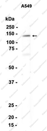Recombinant PCB Monoclonal Antibody - 1