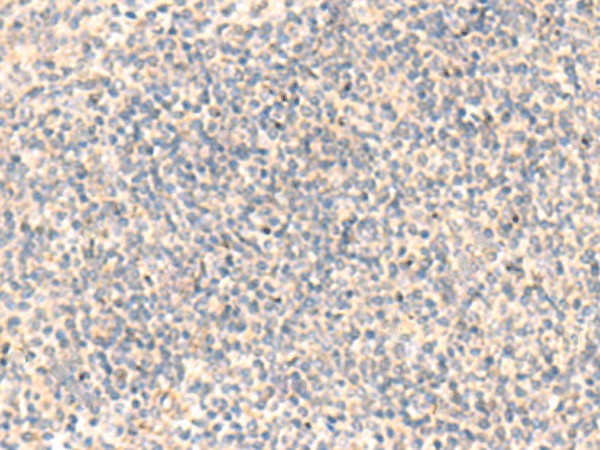 Immunohistochemistry of paraffin-embedded Human tonsil tissue  using ADAMTS2 Polyclonal Antibody at dilution of 1:45(?200)