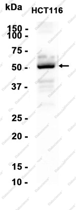 Recombinant CaMKII beta Monoclonal Antibody - 1