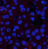 Immunofluorescence analysis of Mouse liver tissue with Phospho-JAK1 (Tyr1022) Polyclonal Antibody at dilution of 1:200