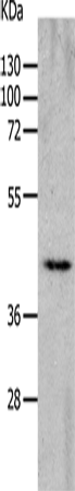 Western Blot analysis of Mouse heart tissue using CHRNA7 Polyclonal Antibody at dilution of 1:700