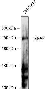 Western blot analysis of extracts of SH-SY5Y cells using NRAP Polyclonal Antibody at 1:3000 dilution.