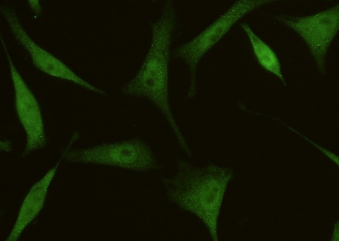 4E-BP1/EIF4EBP1 Monoclonal Antibody - small - 1