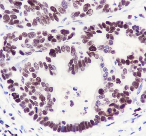 Recombinant DDB2 Monoclonal Antibody - 3